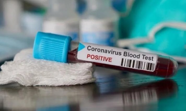 उत्तराखंड : लगातार मिल रहे कोरोना के नए मामले, 38 हुई कुल मरीजों की संख्या